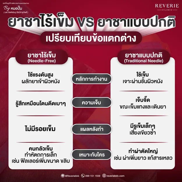 เปรียบเทียบยาชาไร้เข็ม vs ยาชาปกติ