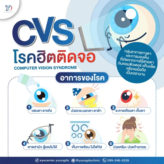CVS โรคฮิตติดจอ