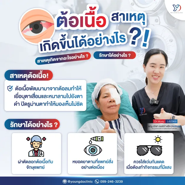 ต้อเนื้อ สาเหตุเกิดขึ้นได้อย่างไร?