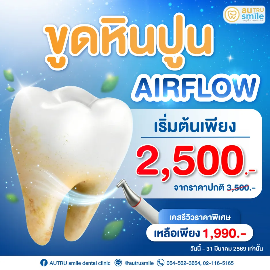 บริการขูดหินปูนด้วยเทคโนโลยี Airflow