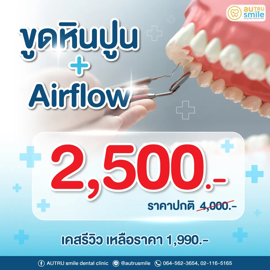 โปรโมชั่นขูดหินปูนร่วมกับระบบ Airflow