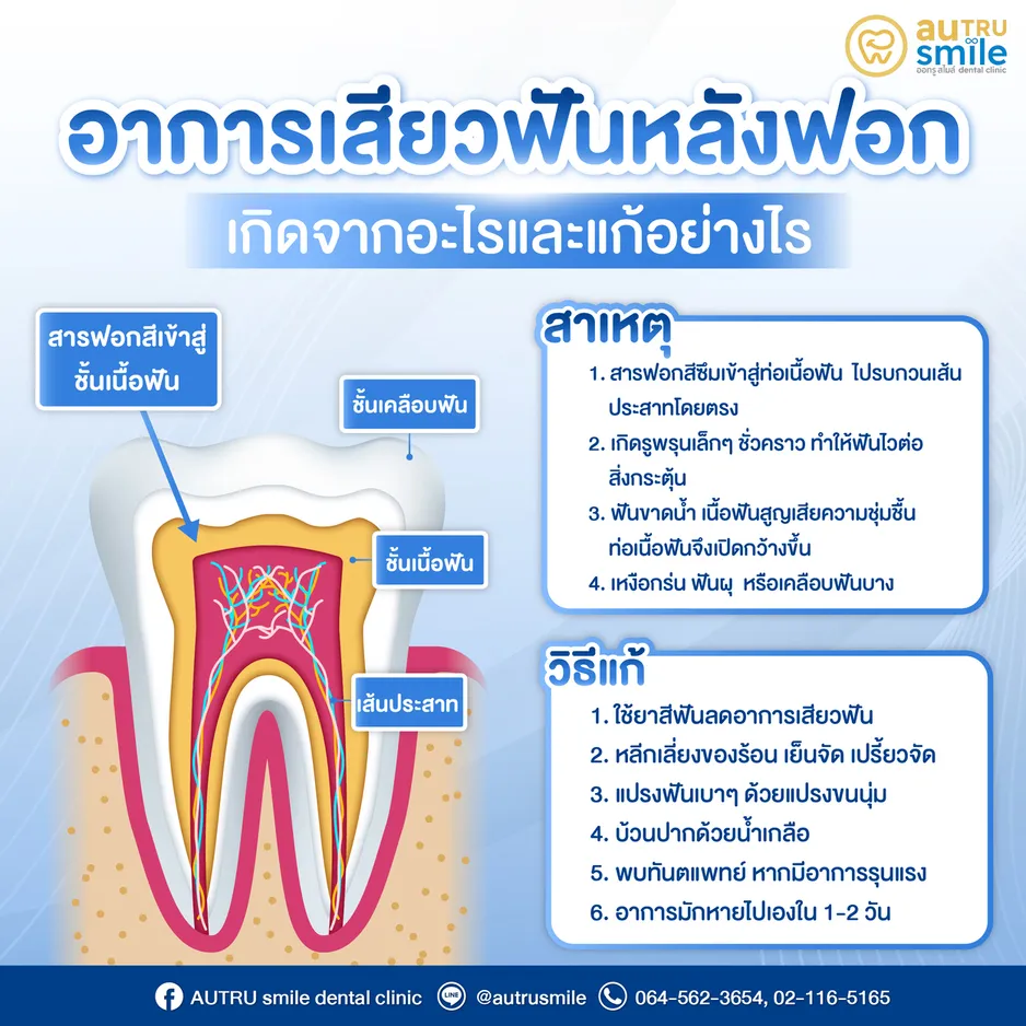 อาการเสียวฟันหลังฟอกสีฟัน สาเหตุและวิธีแก้