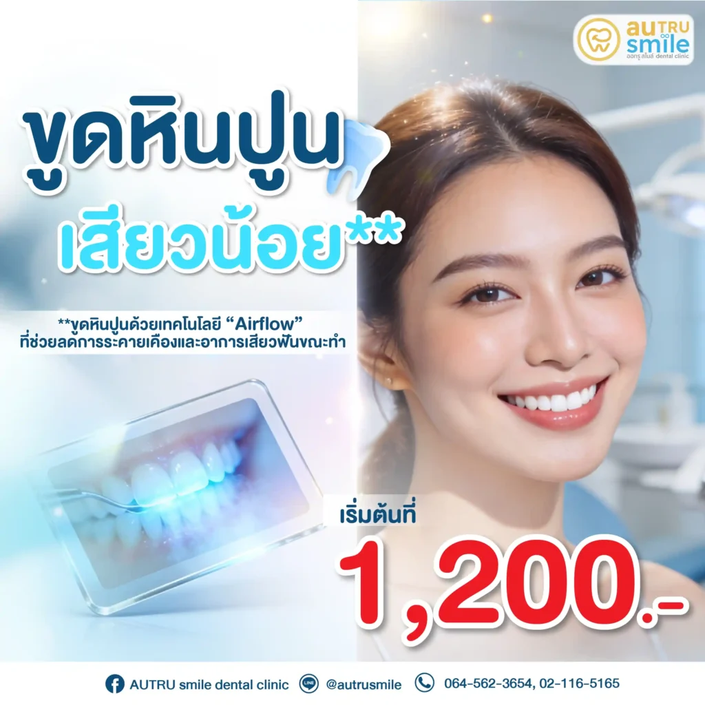 ขูดหินปูนเสียวน้อยด้วย Airflow