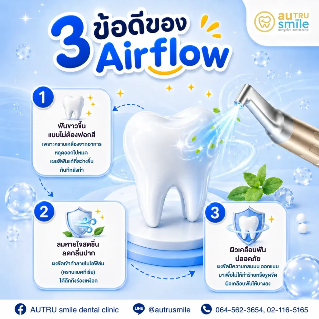 3 ข้อดีของ Airflow