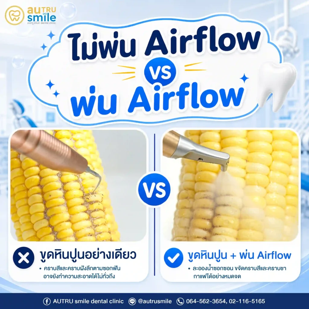 เปรียบเทียบขูดหินปูนอย่างเดียว vs +Airflow