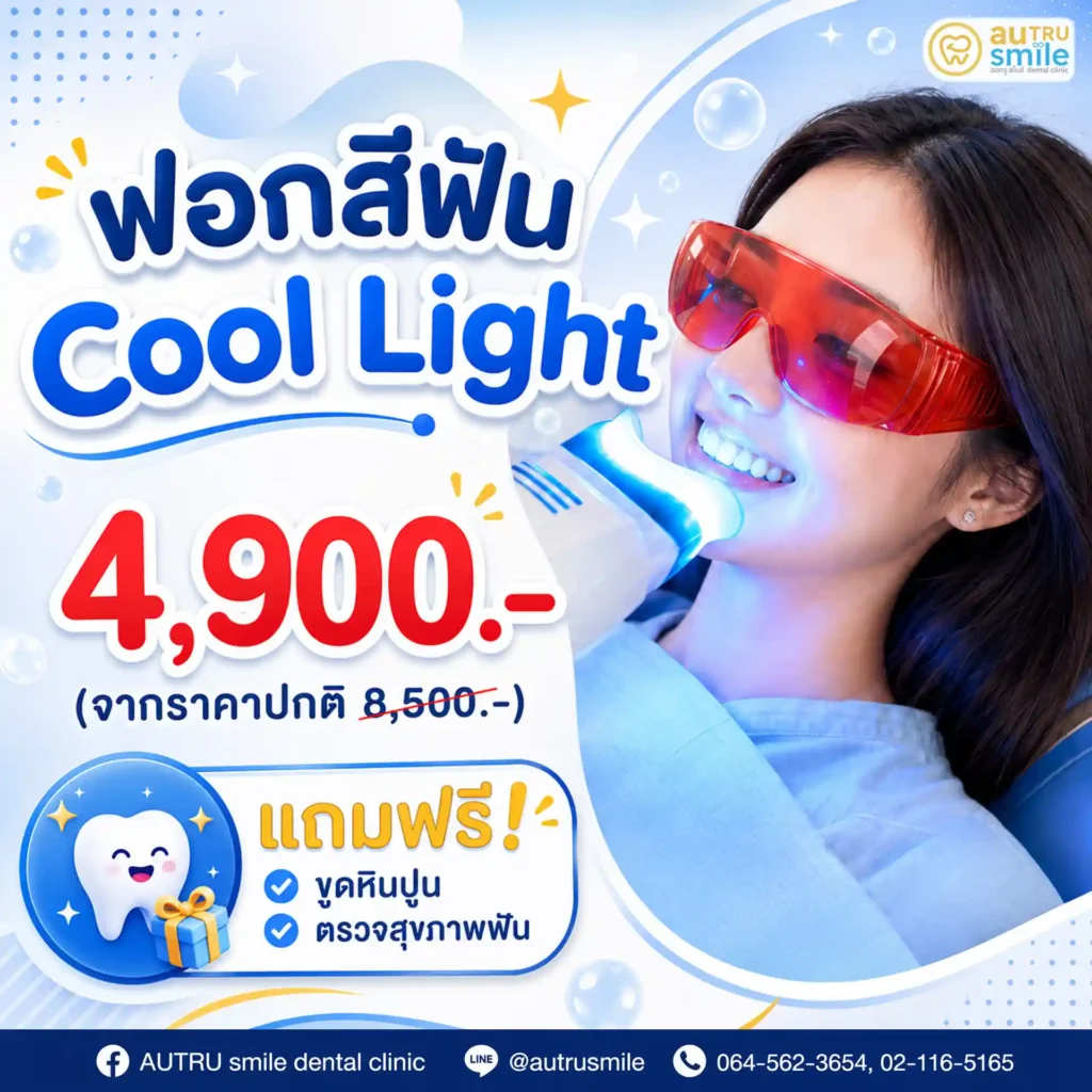 ฟอกสีฟัน Cool Light