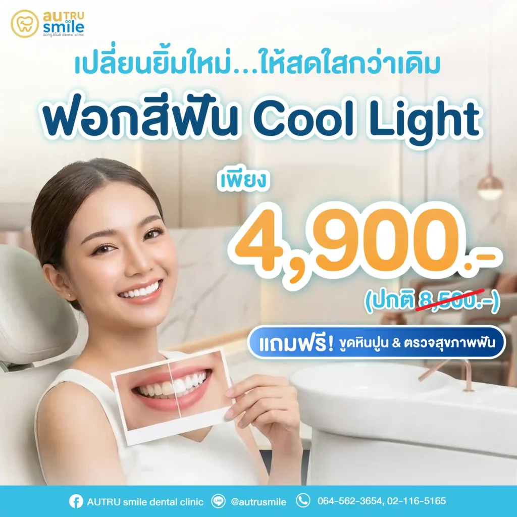ฟอกสีฟัน Cool Light เปลี่ยนยิ้มใหม่