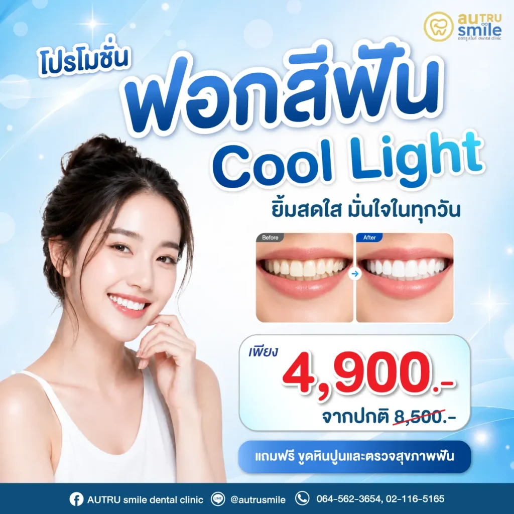 โปรโมชั่นฟอกสีฟัน Cool Light 02