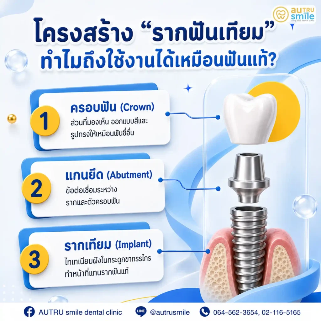 โครงสร้างรากฟันเทียม