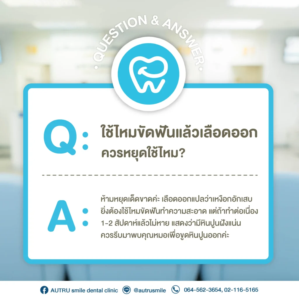 Q&A ไหมขัดฟันเลือดออก