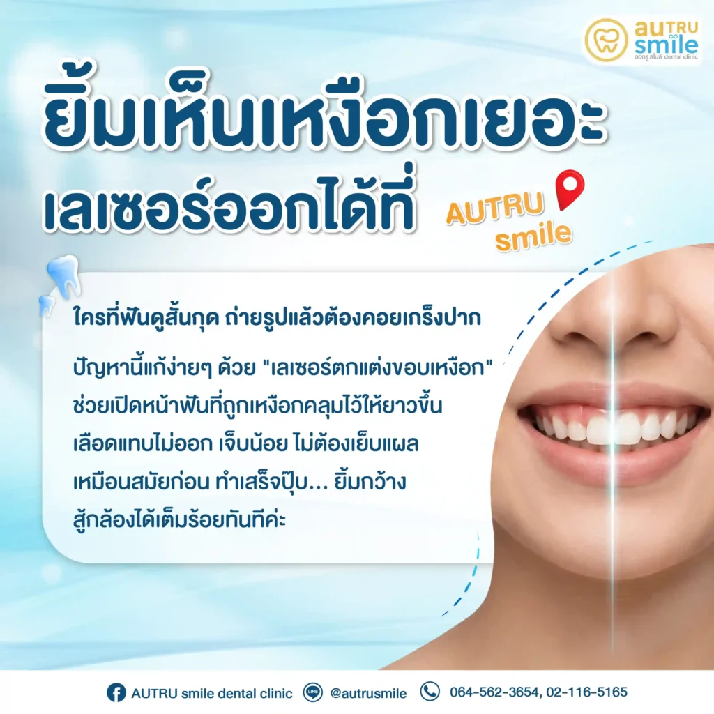 ยิ้มเห็นเหงือกเยอะ เลเซอร์แต่งขอบเหงือก
