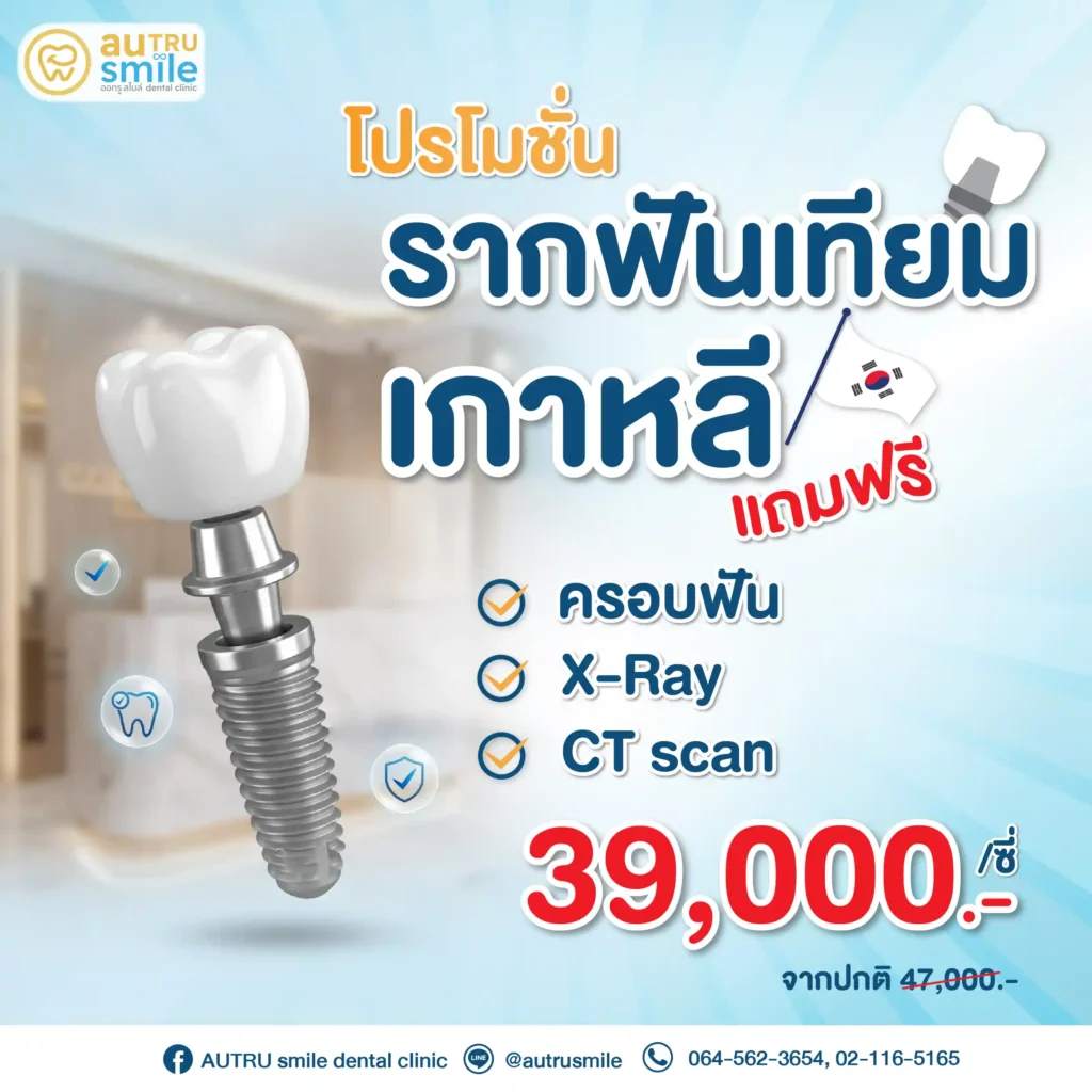 รากฟันเทียมเกาหลี 02