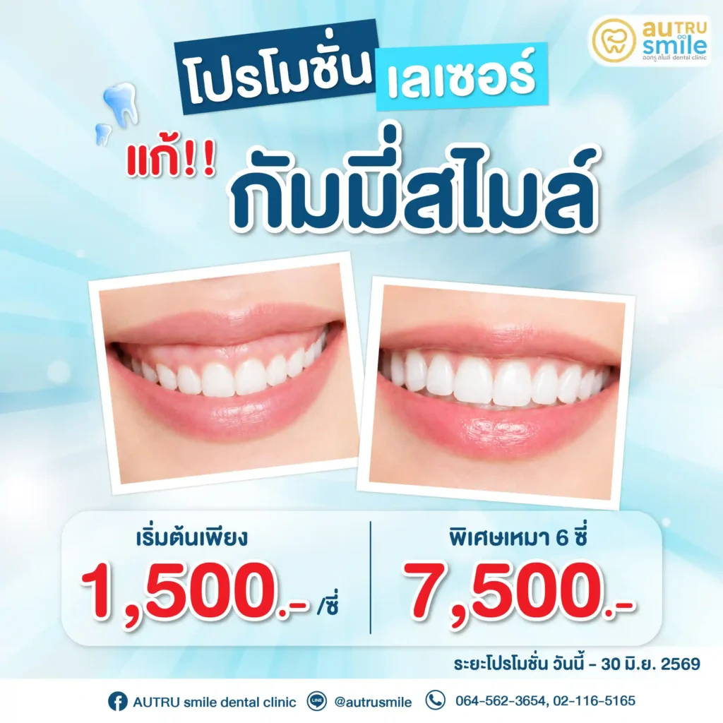 โปรโมชั่นเลเซอร์แก้กัมมี่สไมล์