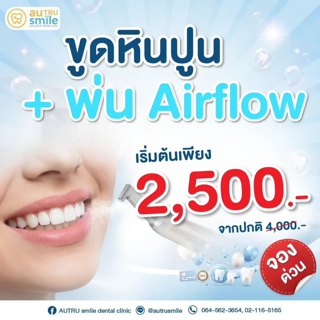 ขูดหินปูน+พ่น Airflow