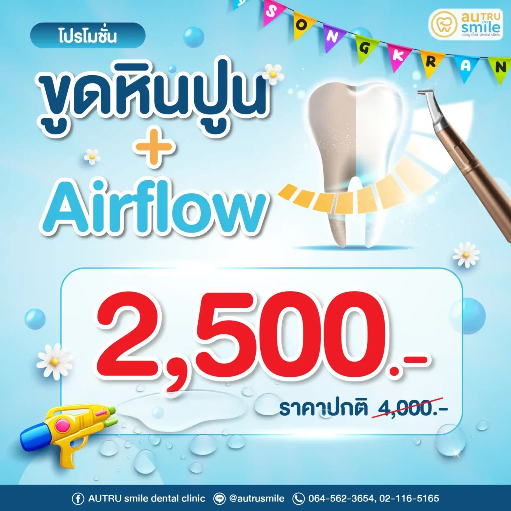 ขูดหินปูน+Airflow เทศกาลสงกรานต์