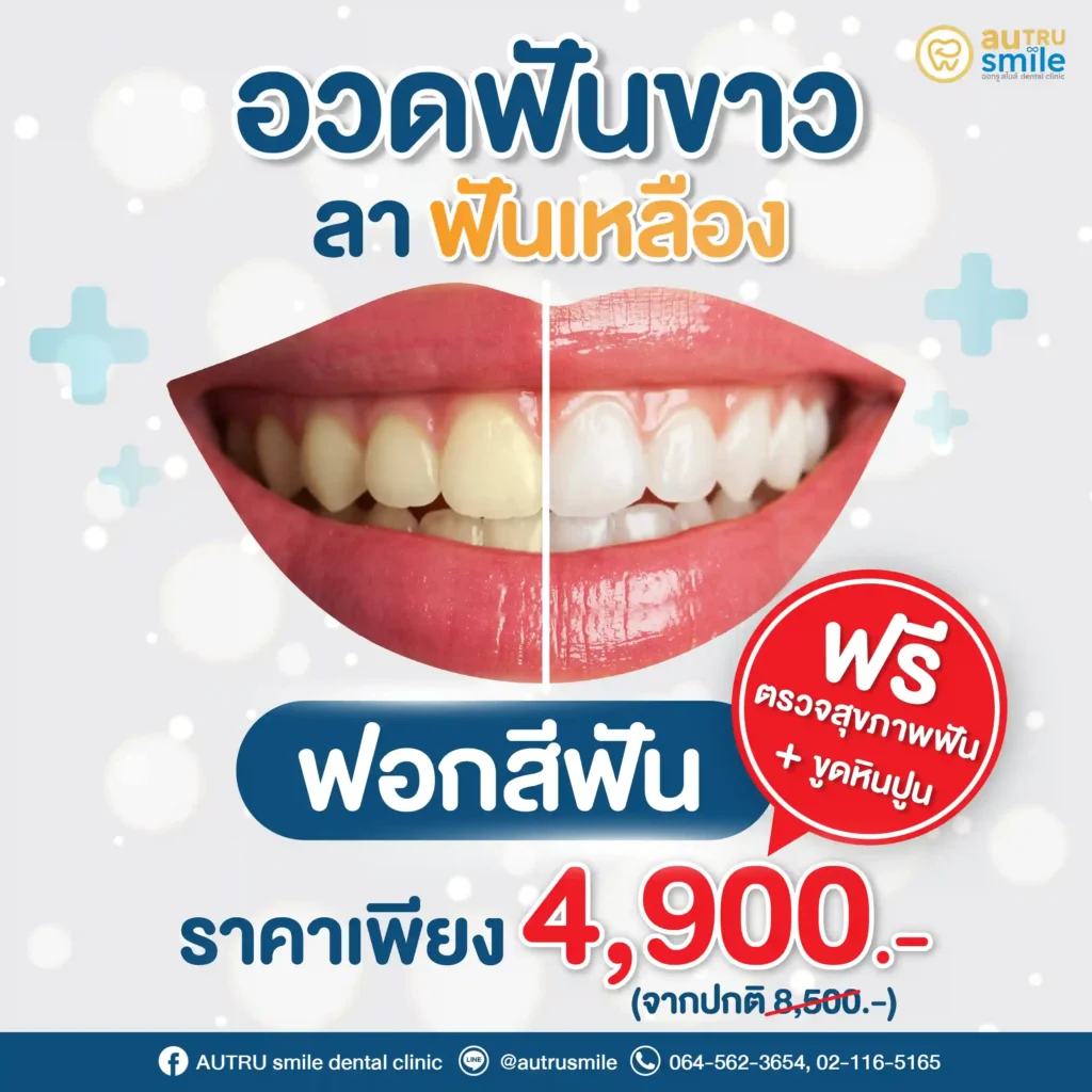 อวดฟันขาว ลาฟันเหลือง