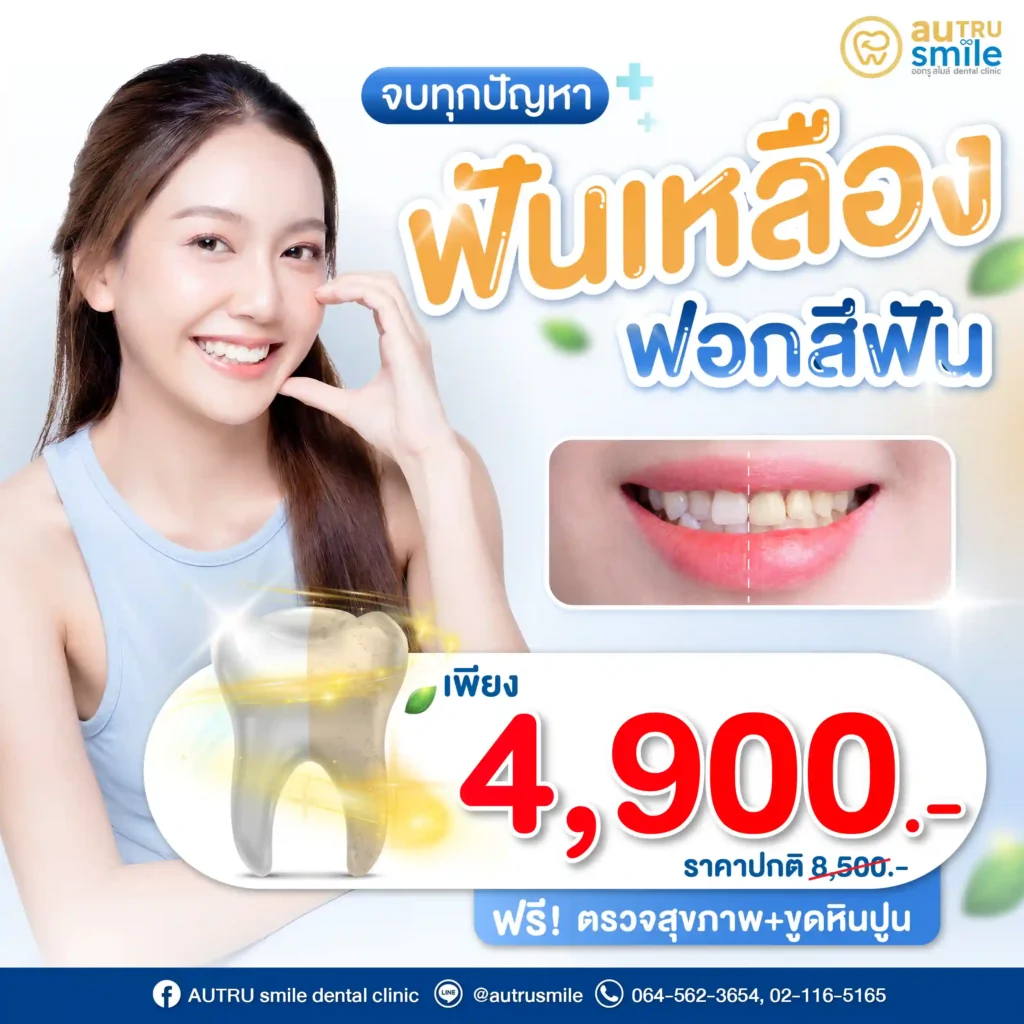 โปรโมชันฟอกสีฟัน