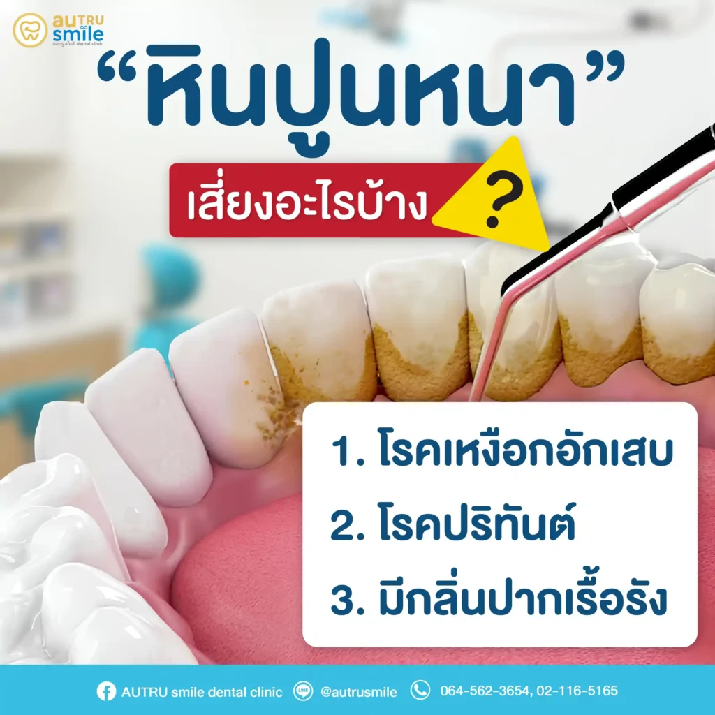 หินปูนหนา เสี่ยงอะไรบ้าง