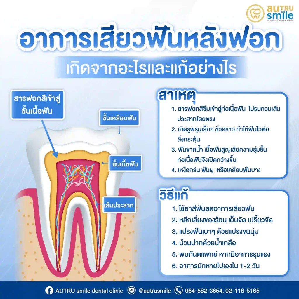อาการเสียวฟันหลังฟอก