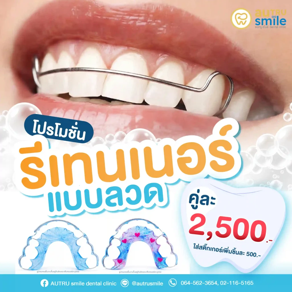 โปรโมชั่นรีเทนเนอร์แบบลวด